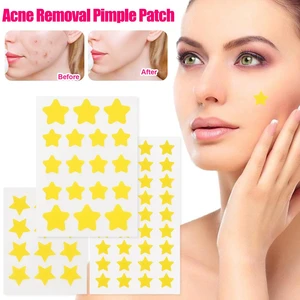 Pimple Patch Acne Concealer Face Spot Coloful Invisible Acne Removal Skin Care Stickers Beauty Acne Tool