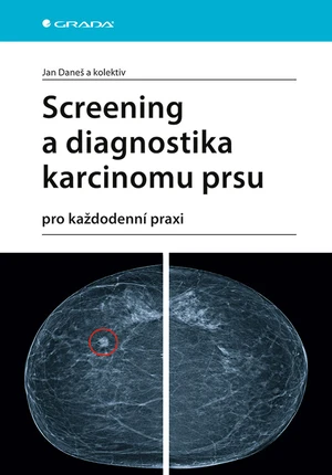 Kniha: Screening a diagnostika karcinomu prsu od Daneš Jan