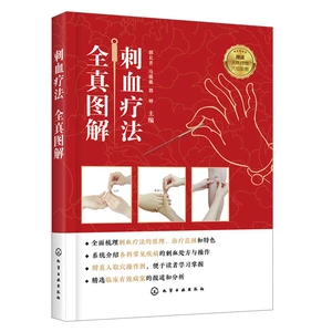 Complete Picture of Blood Pricking Therapy, Book of Blood Pricking Therapy, Complete Book of Blood Pricking Therapy In China