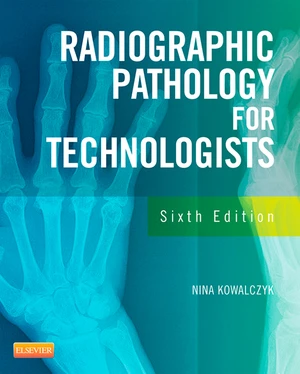 Radiographic Pathology for Technologists - E-Book