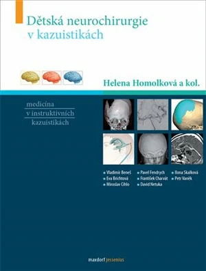 Dětská neurochirurgie v kazuistikách - Homolková Helena