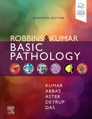 Robbins & Kumar Basic Pathology, E-Book