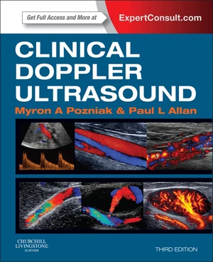 Clinical Doppler Ultrasound E-Book