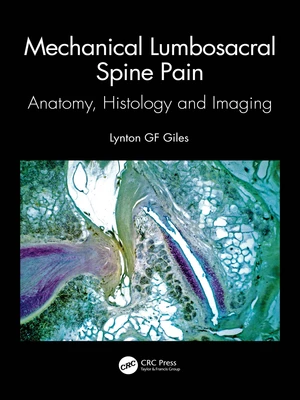 Mechanical Lumbosacral Spine Pain