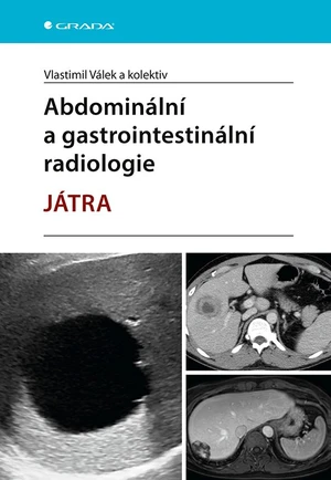 Kniha: Abdominální a gastrointestinální radiologie od Válek Vlastimil