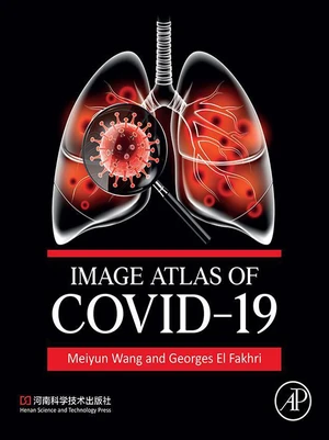 Image Atlas of COVID-19