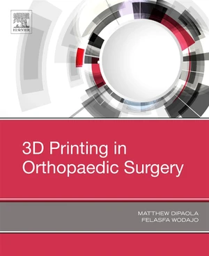 3D Printing in Orthopaedic Surgery