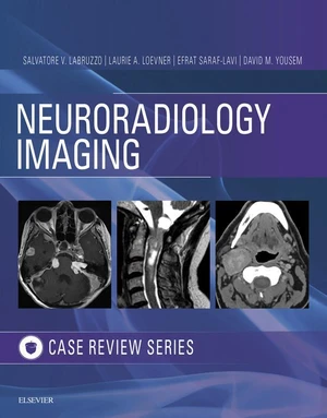 Neuroradiology Imaging Case Review E-Book