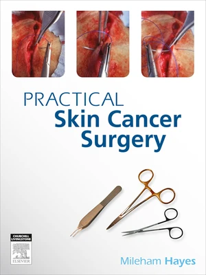 Practical Skin Cancer Surgery