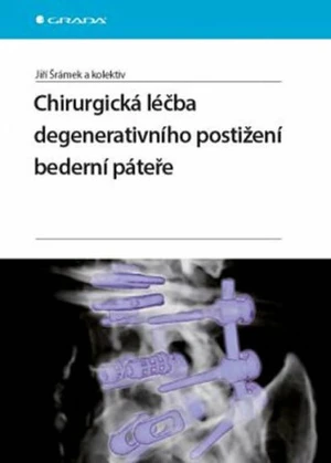 Chirurgická léčba degenerativního postižení bederní páteře - Jiří Šrámek