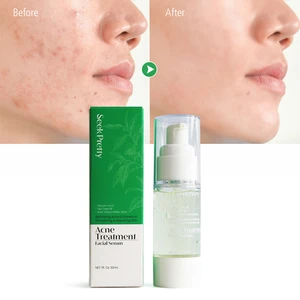 Seekpretty Acne Treatment Facial Serum Removing Acne and Breakout Smoothing Repairing Skin Moisturizing for Healthier Skin