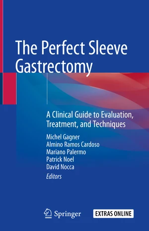 The Perfect Sleeve Gastrectomy