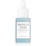 SKIN1004 Madagascar Centella Hyalu-Cica Blue Serum intenzívne hydratačné sérum pre upokojenie a posilnenie citlivej pleti 30 ml