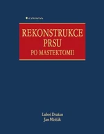 Rekonstrukce prsu po mastektomii - Jan Měšťák, Luboš Dražan - e-kniha