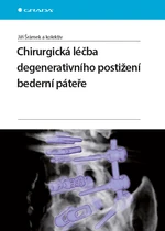 Kniha: Chirurgická léčba degenerativního postižení bederní páteře od Šrámek Jiří