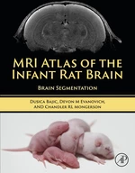 MRI Atlas of the Infant Rat Brain