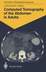 Computed Tomography of the Abdomen in Adults