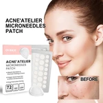 Acne Pimple Patch Stickers Acne Treatment Pimple Remover Tool Blemish Spot Facial Mask Skin Care Waterproof 72 Patches