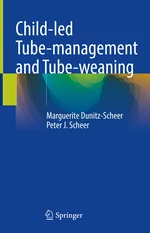 Child-led Tube-management and Tube-weaning