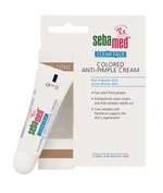 Sebamed Tónovací krém na akné Clear Face (Coloured Anti-Pimple Cream) 10 ml