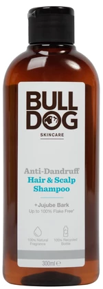 BULLDOG Anti-Dandruff Shampoo - šampón na vlasy proti lupům 300 ml