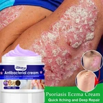 Itching Cream External Use Anti-Itching Skin Problems Dermatitis Eczema Treatment Psoriasis Cream Antibacterial Cream