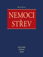 Nemoci střev - Karel Lukáš, Jiří Hoch - e-kniha