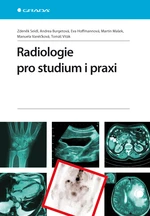 Kniha: Radiologie pro studium i praxi od Seidl Zdeněk