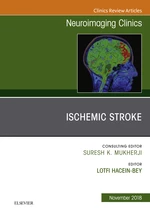 Ischemic Stroke, An Issue of Neuroimaging Clinics of North America