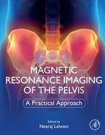 Magnetic Resonance Imaging of The Pelvis