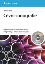 Cévní sonografie, Cholt Milan