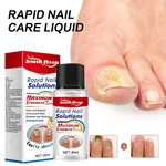 Nail Fungus Treatments Serum 20ml Foot Care Serum Toe Nails Fungal Removal Gel Anti-Infection Toe Fungus Hand Foot Onychomycosis