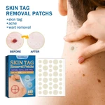 180pcs/set Face Skin Care Acne Pimple Patch Invisible Professional Healing Absorbing Spot Sticker Covering For Men Women