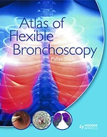 Atlas of Flexible Bronchoscopy