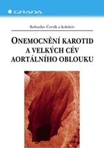 Onemocnění karotid a velkých cév aortálního oblouku - Bohuslav Čertík - e-kniha