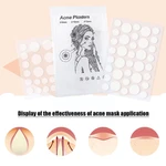 24/36Patches Invisible Acne Removal Patch Fast Absorb Acne Skin Remover Care Secretions Mask Acne beauty Masks W5T9