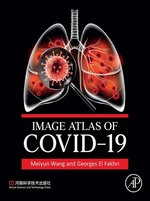 Image Atlas of COVID-19