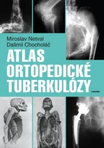 Atlas ortopedické tuberkulózy - Dalimil Chocholáč, Miroslav Netval - e-kniha