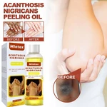 30ml Peeling Oil Dark Skin Bleaching Remove Arm Knee Scrub Dead Body Lightening Exfoliating Serum Whitening Skin Legs Melan Q9M3