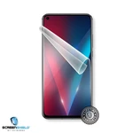 ScreenShield fólia kijelzőre Honor View 20 - Élettartam garancia